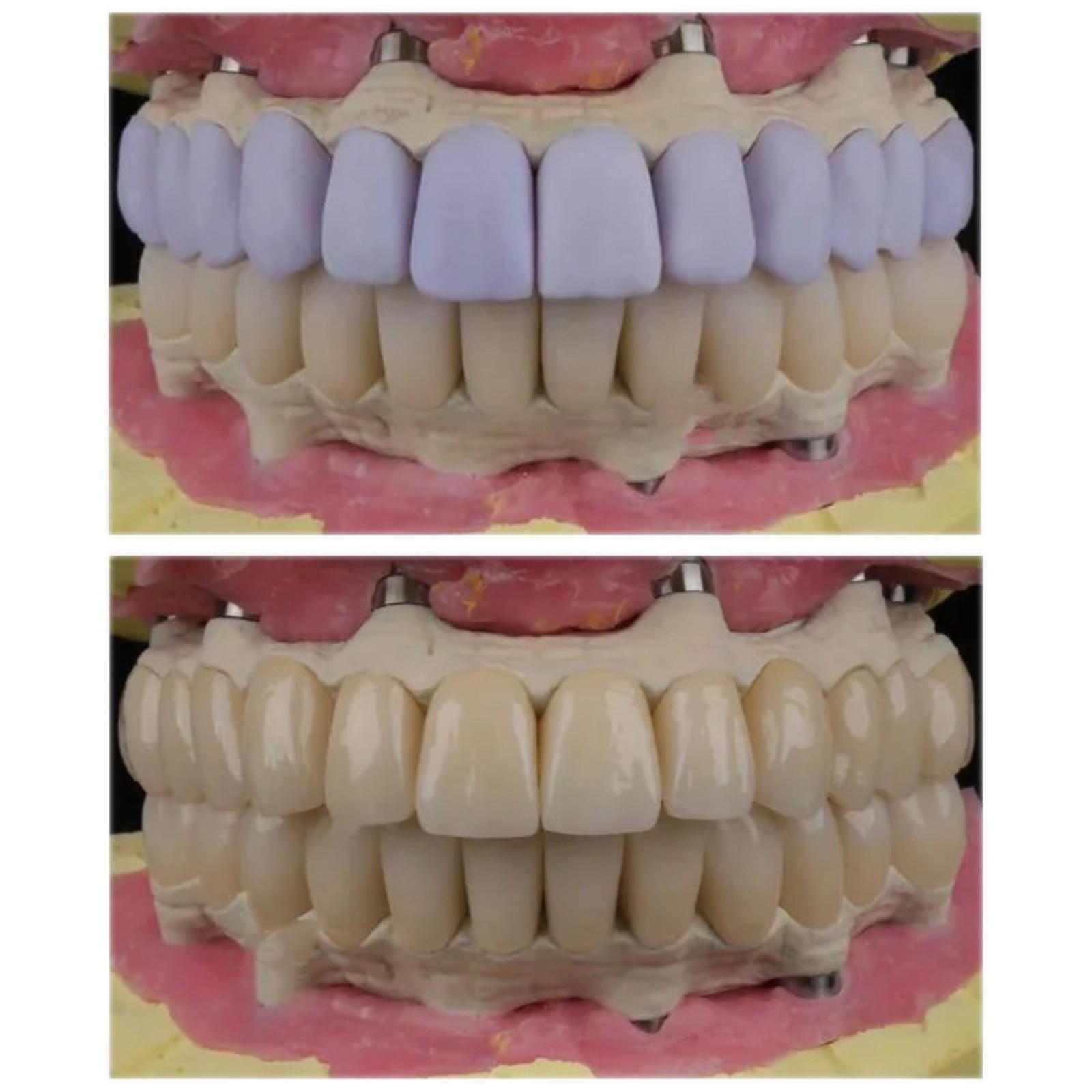 C14 Exam Lithium Disilicate Blocks CAD/CAM Dental Lab CEREC Compatible 5Pcs/Box