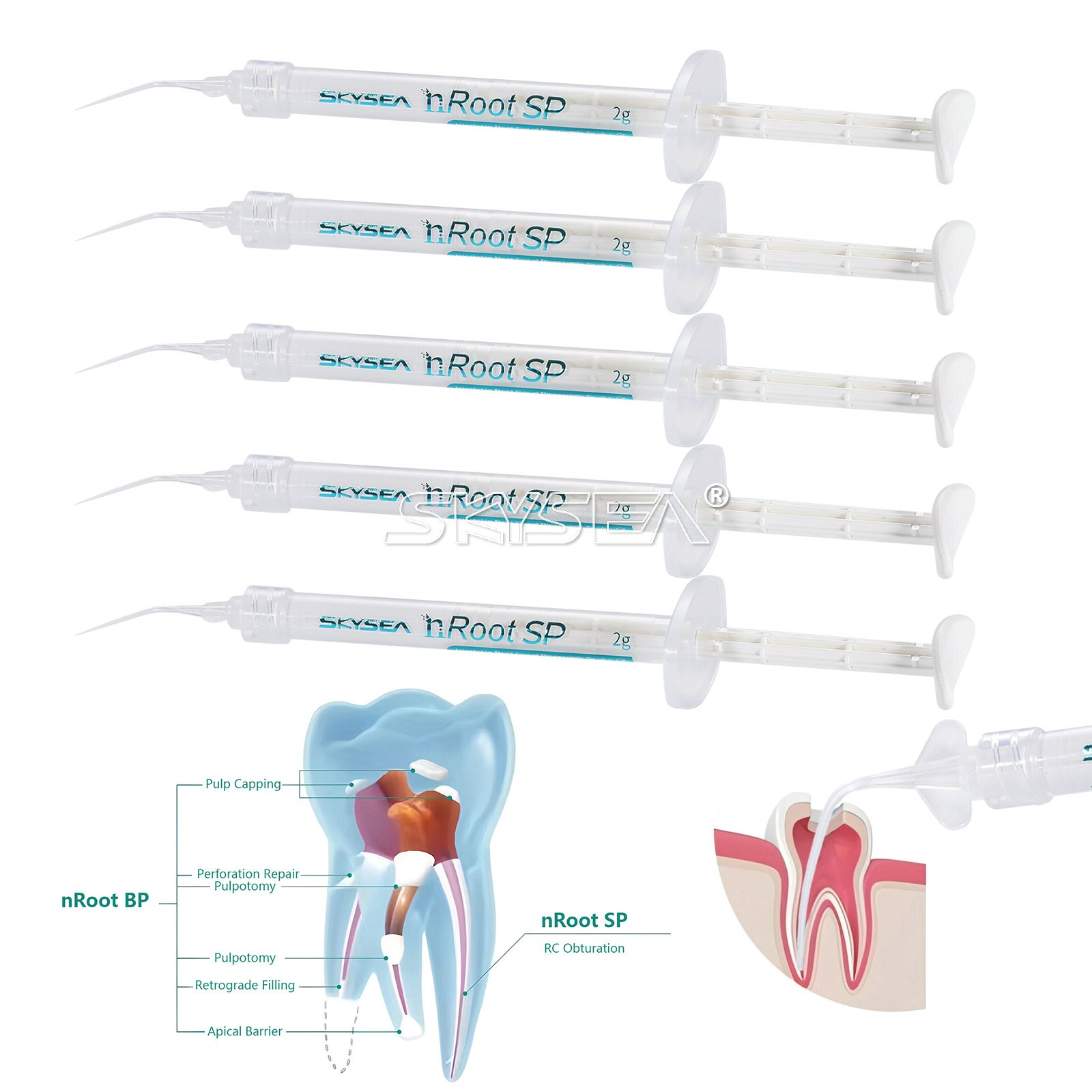 2g nRoot SP Sealer Bioceramic Inject Root Canal Sealing Material Filling Cement