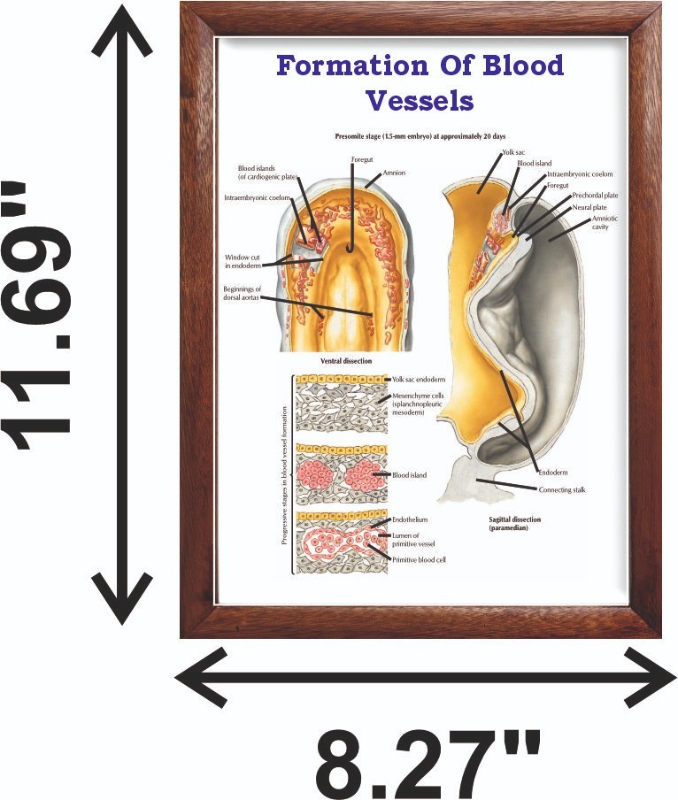 Formation Of Blood Vessels Chart 12×18 inches
