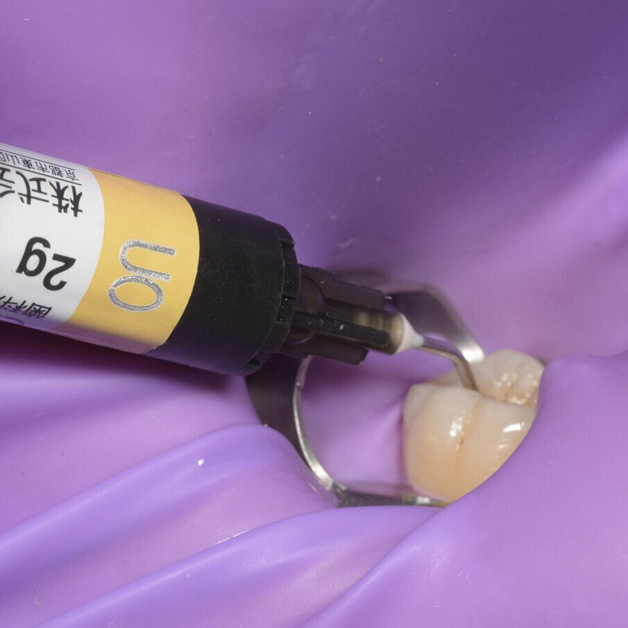 RMGI Self Adhesive Resin Permanent Dental Cement For All Ceramic Crowns 8gm Syr.