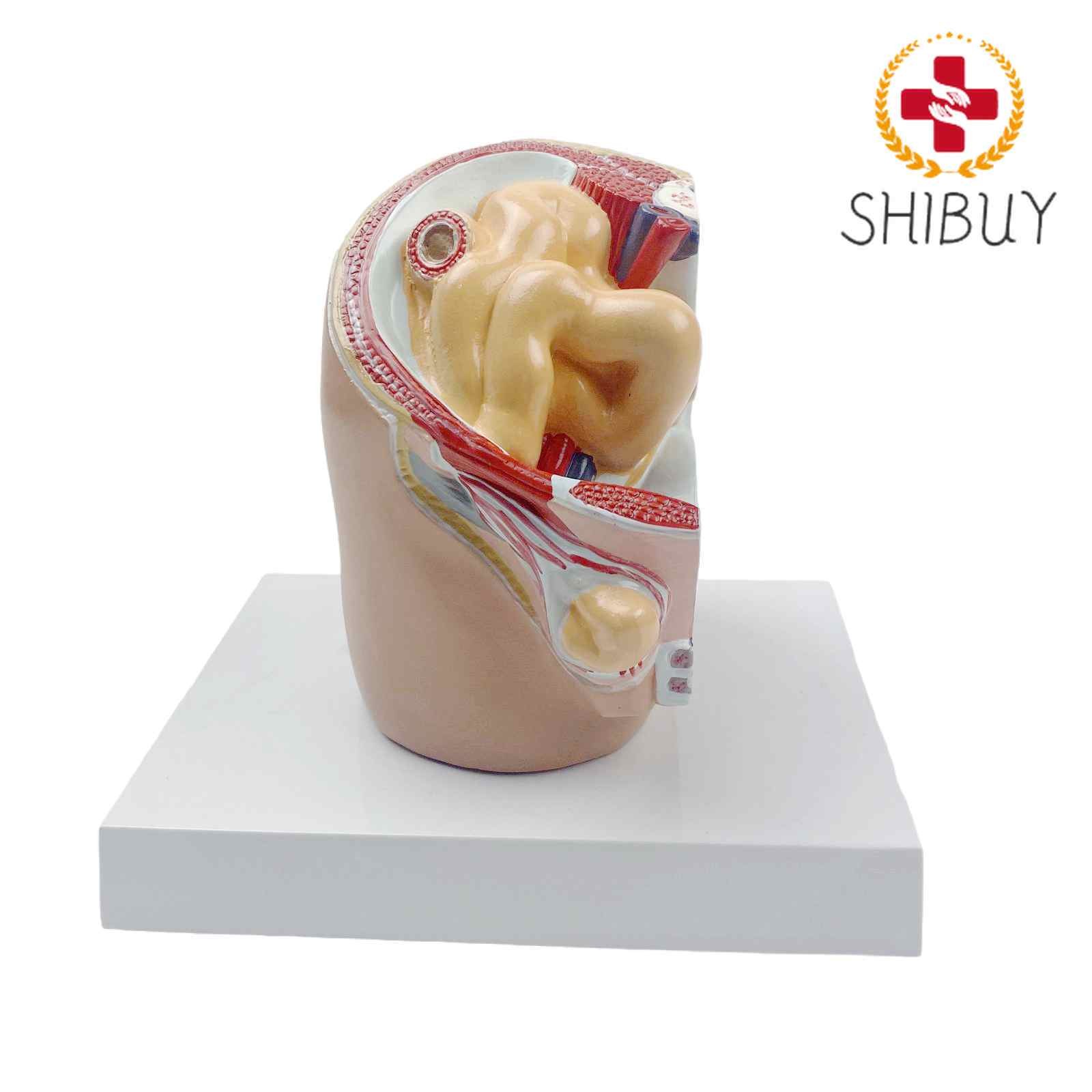 Human Oblique Inguinal Hernia Pathological Skin Model Medical Teaching Models
