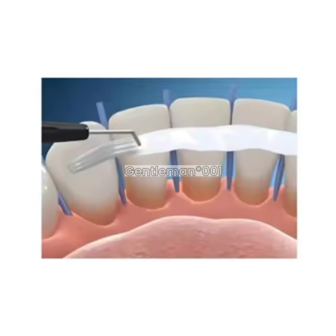 Dental Flexible Fiber Strip Band Retainer Glass Splint Loose Tooth Light Cure
