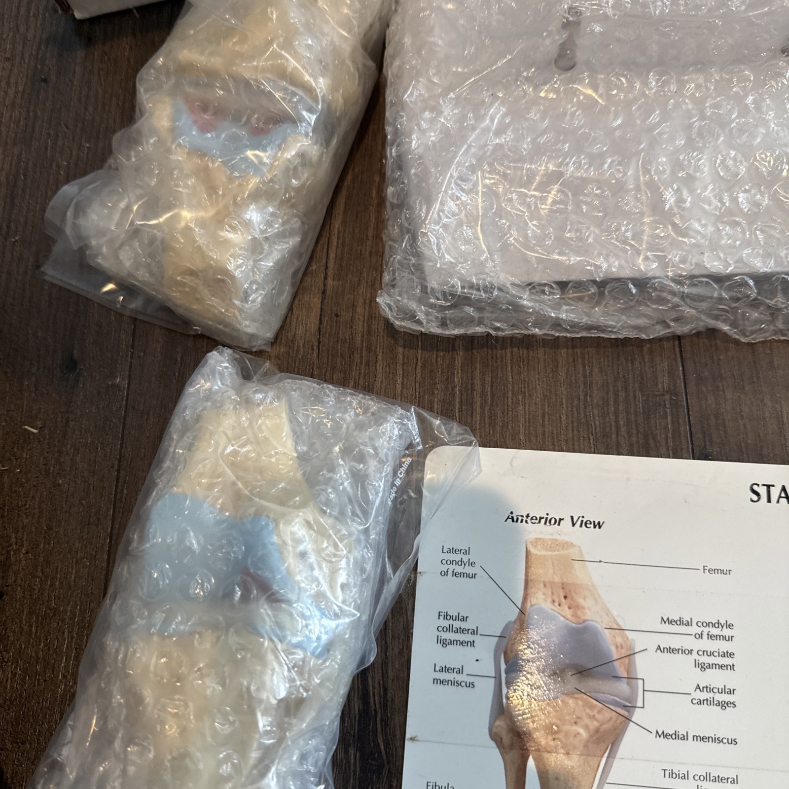 Knee Joint Osteoarthritis GPI Model Set horizon pharma
