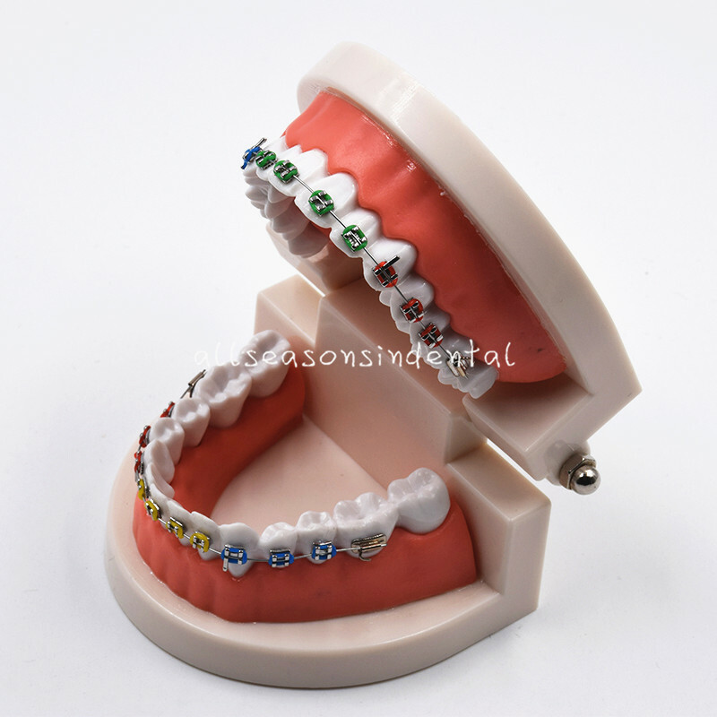 Dental Orthodontic Adult Standard Teeth Hoop Model Metal Brackets Ligature Tie