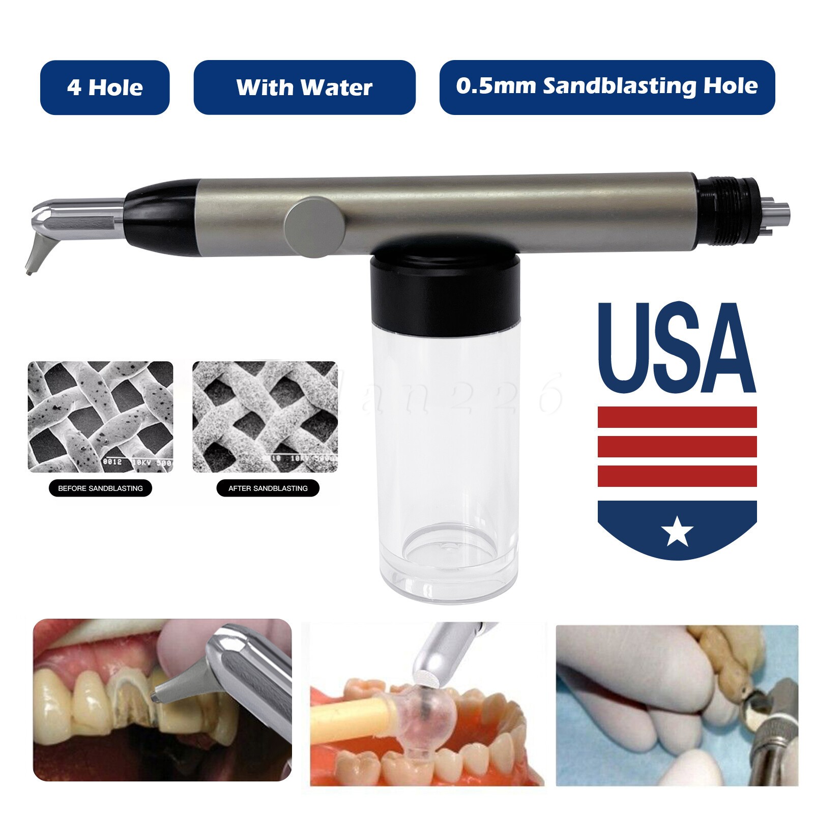 Dental Aluminum Oxide Micro Blaster Air Polisher Abrasion Microetcher w/ Water