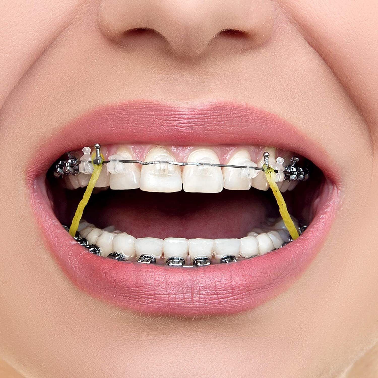 100PCS JMU Dental Orthodontics Intraoral Elastic Rubber Bands Latex Heavy – 1/4