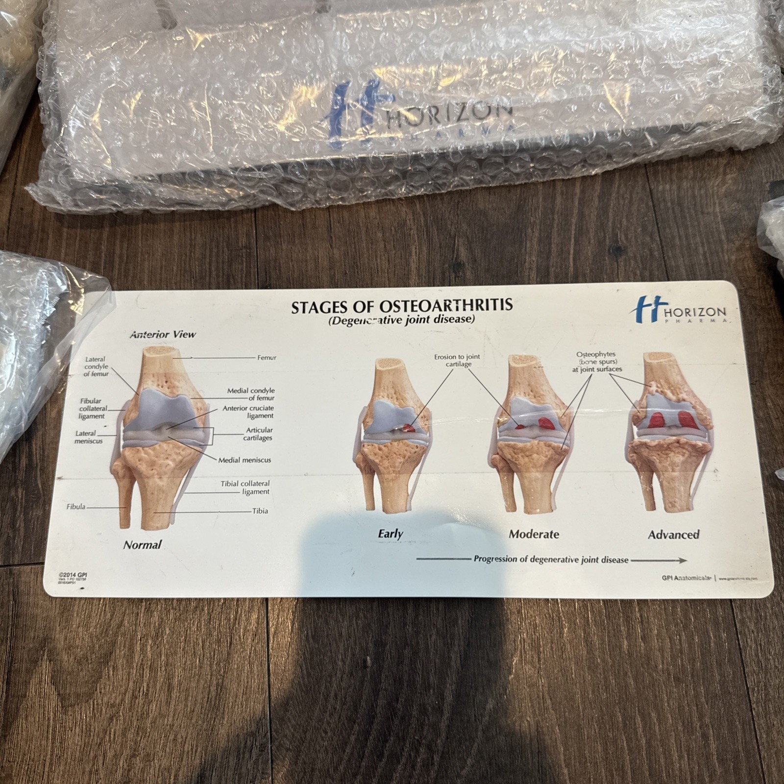 Knee Joint Osteoarthritis GPI Model Set horizon pharma