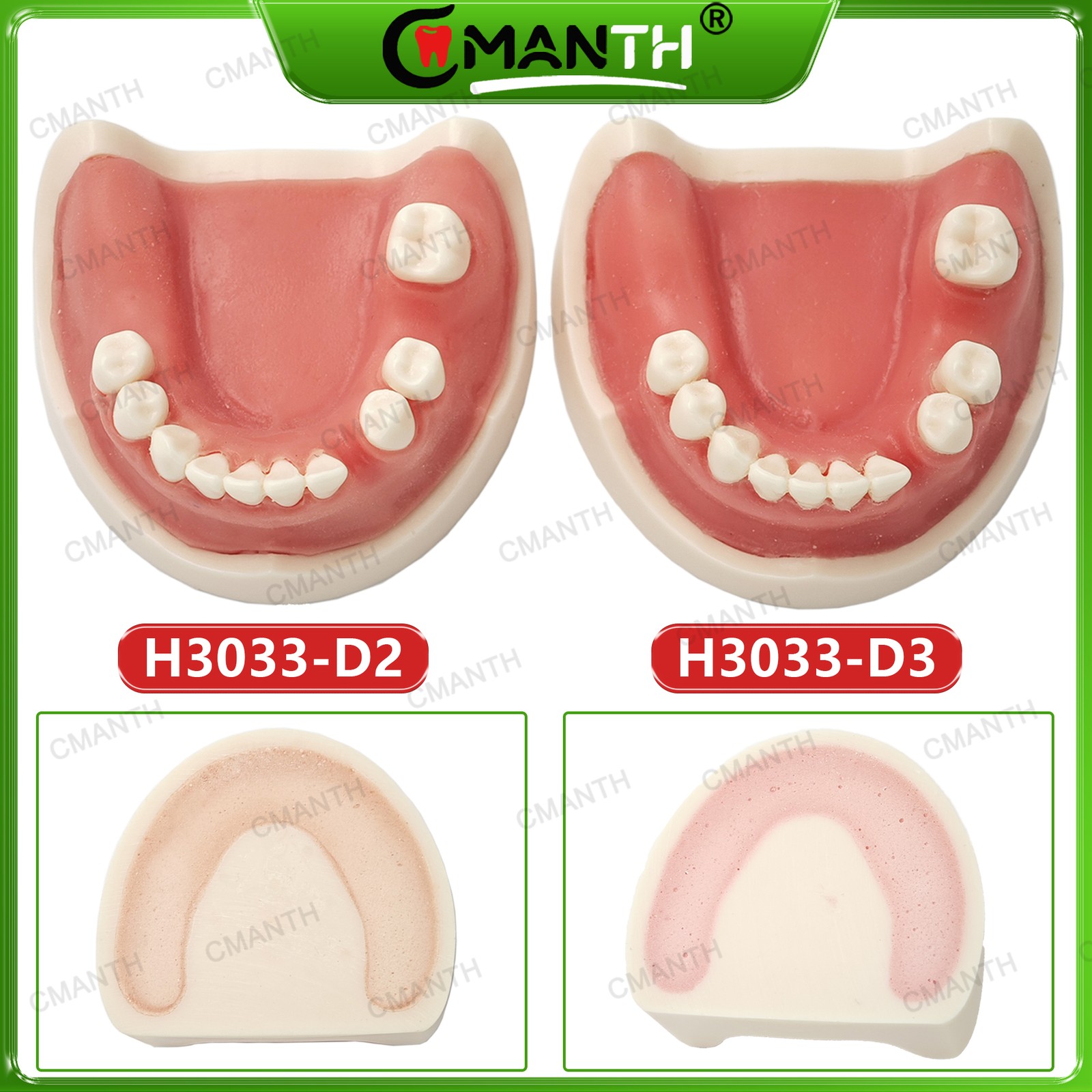 Multiple Types Dental Teeth Model Ortho Implant Practice Teaching Demo Model