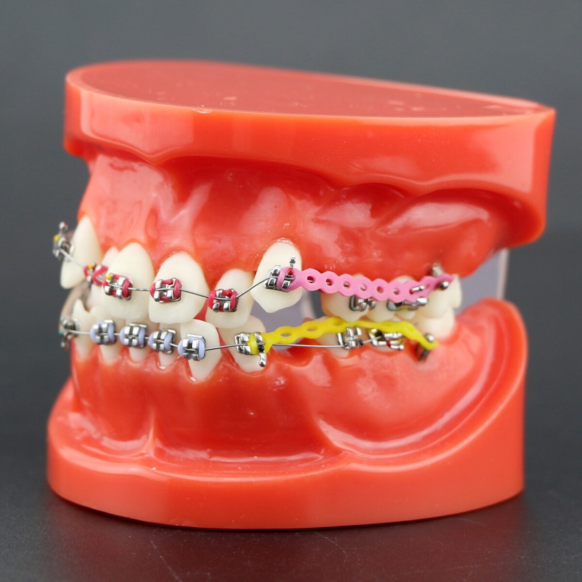 Dental Typodont Teeth Model Orthodontic Treatment Metal Ceramic BracketsRetainer