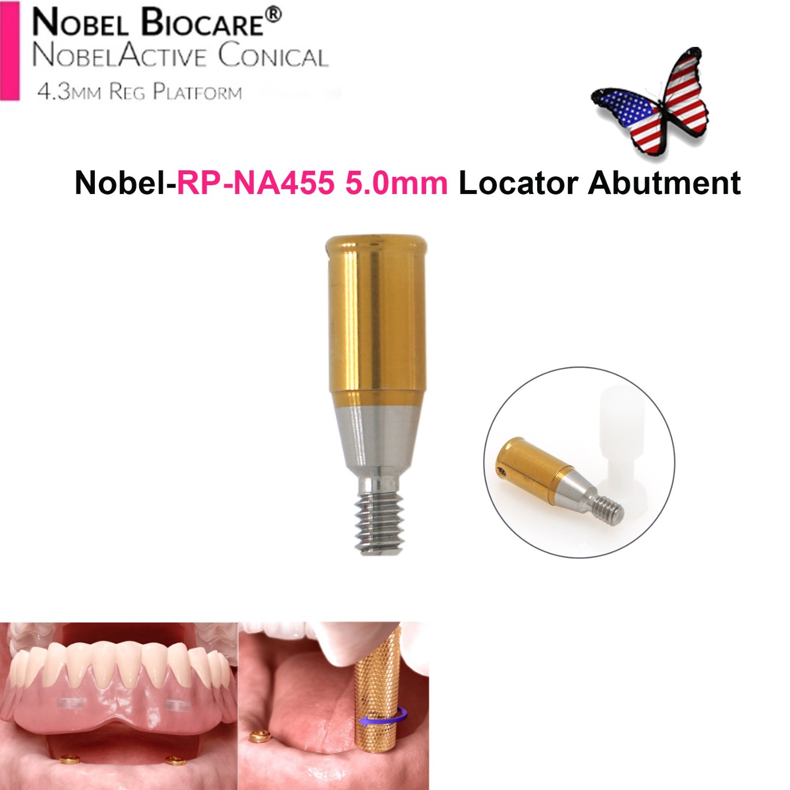 Dental Locator Abutment NP RP Compatible with Nobel NBL Active Implant AH 1–5mm