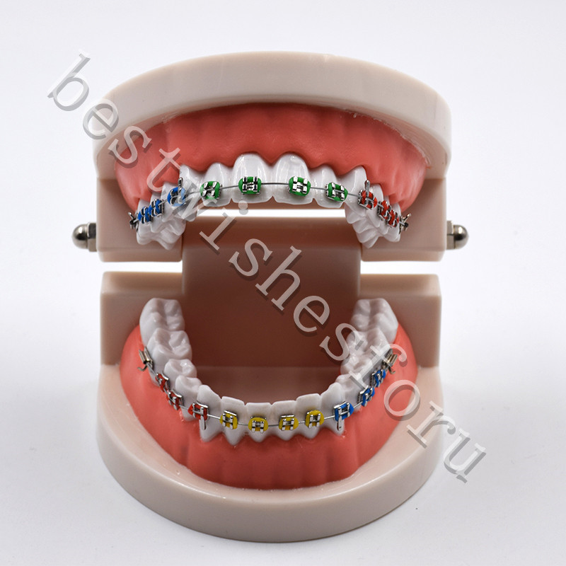 Dental Orthodontic Standard Teeth With Metal Brackets Ligature Ties Hoop Model