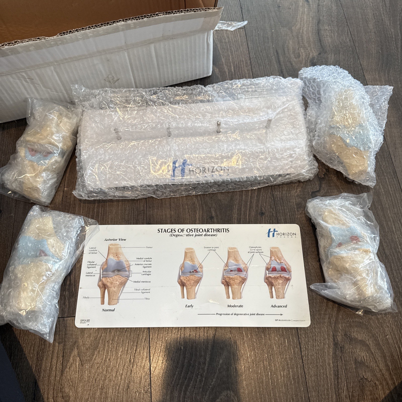 Knee Joint Osteoarthritis GPI Model Set horizon pharma