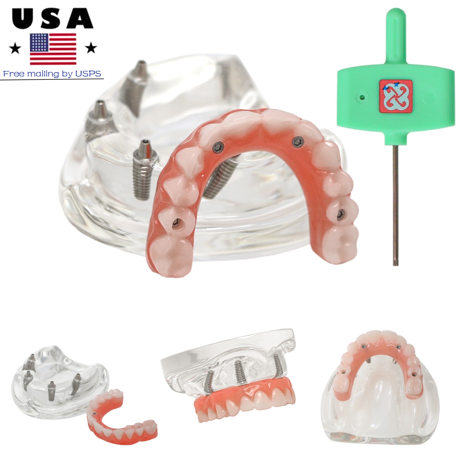 US Overdenture All-On-4/6 Implant /Ortho/Columbia 860/Kilgore NISSIN Teeth Model