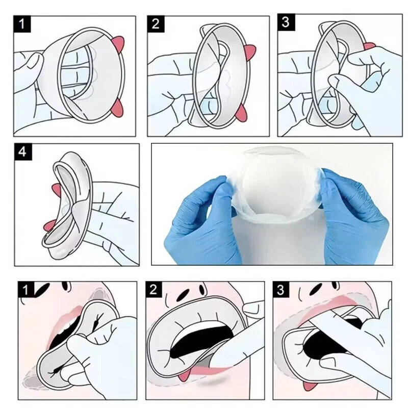 10pcs Ivoclar Vivadent Optragate 3D Lip Cheek Retractor Dental Mouth Opener