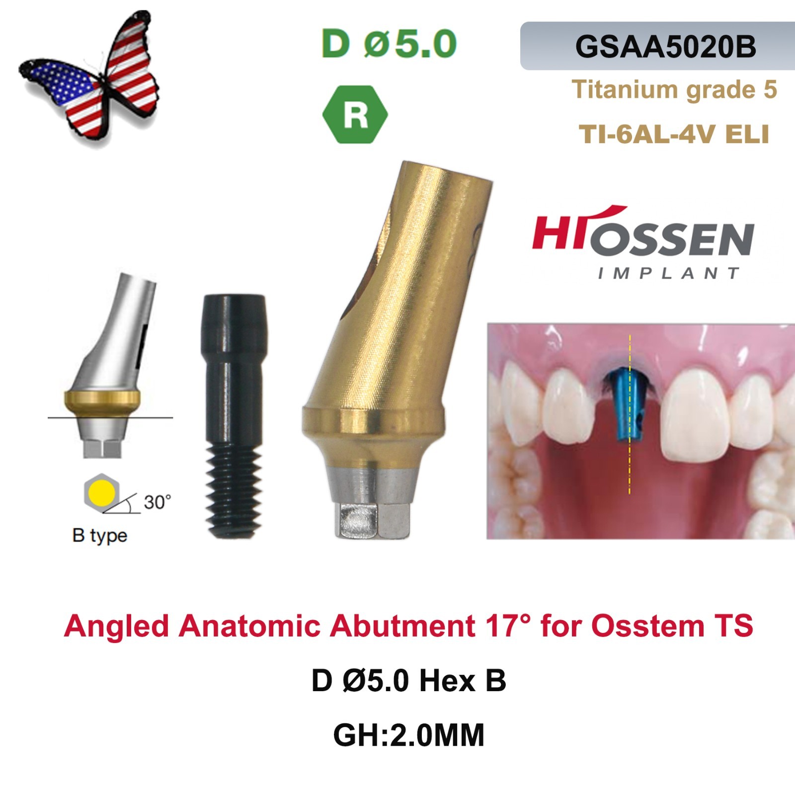 US 5Pcs 17° Angled Anatomic Abutment Hiossen Osstem Mini Regular Hex Titanium
