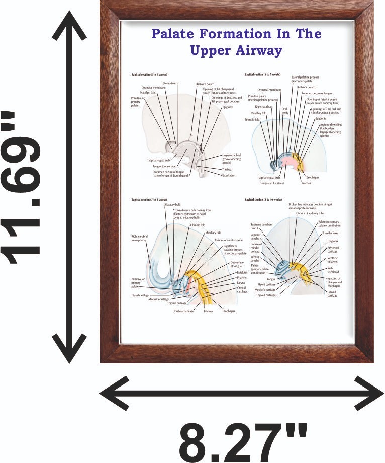 Palate Formation In The Upper Airway Chart 12×18 inches