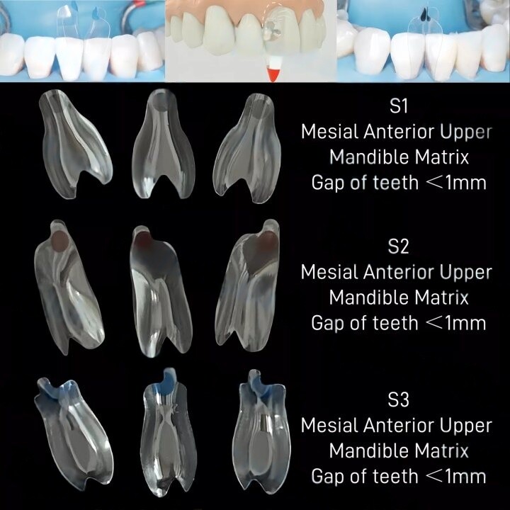 Dental Blue View Strip Anterior Restoration Strips Composite BT Clear Matrix