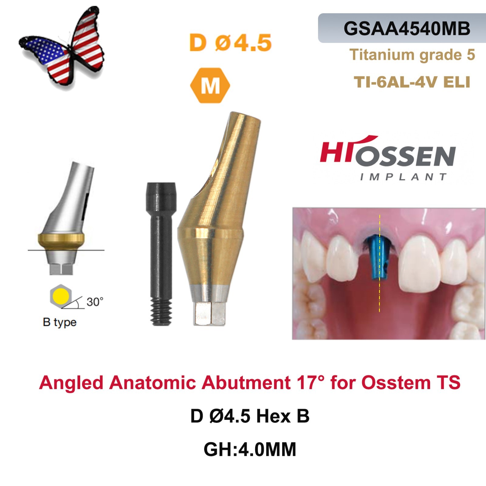 US 17° Dental Angled Anatomic Abutment Hiossen/Osstem TS Mini/Regular Platform