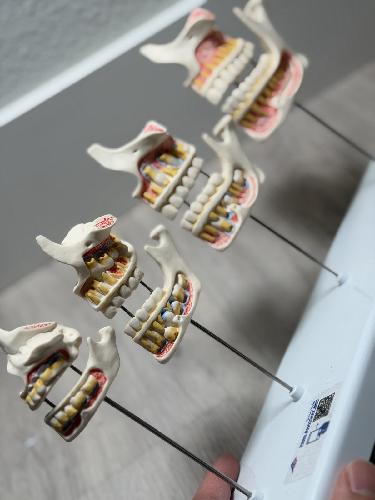 3B Scientific Dentition Development Model – 4 Stages Dental Teeth education