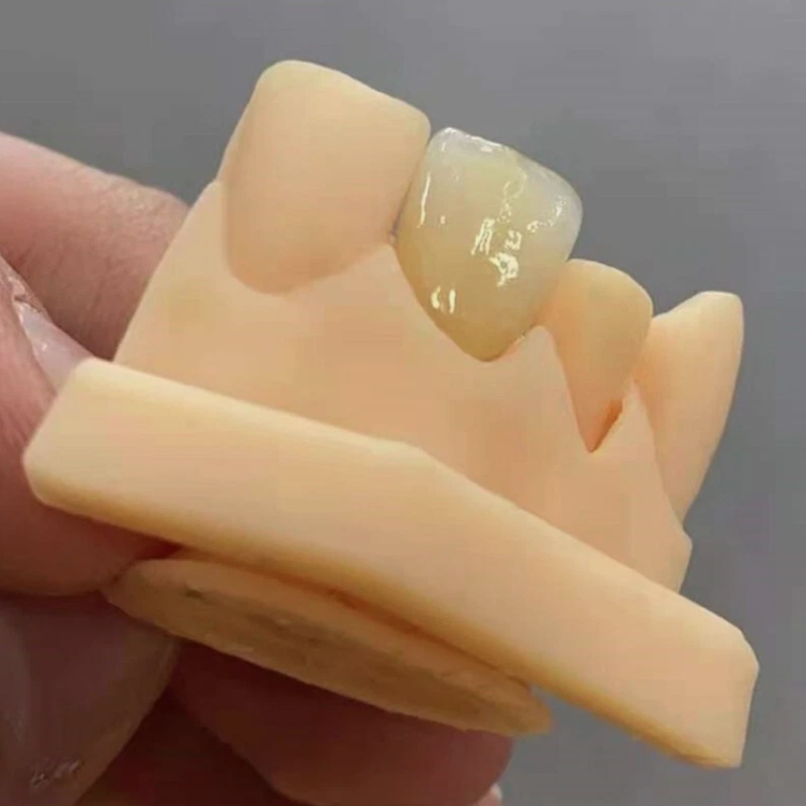 C14LT CEREC Dental Emax Glass Ceramic Blocks Lithium Disilicate CAD/CAM 5Pcs/Box