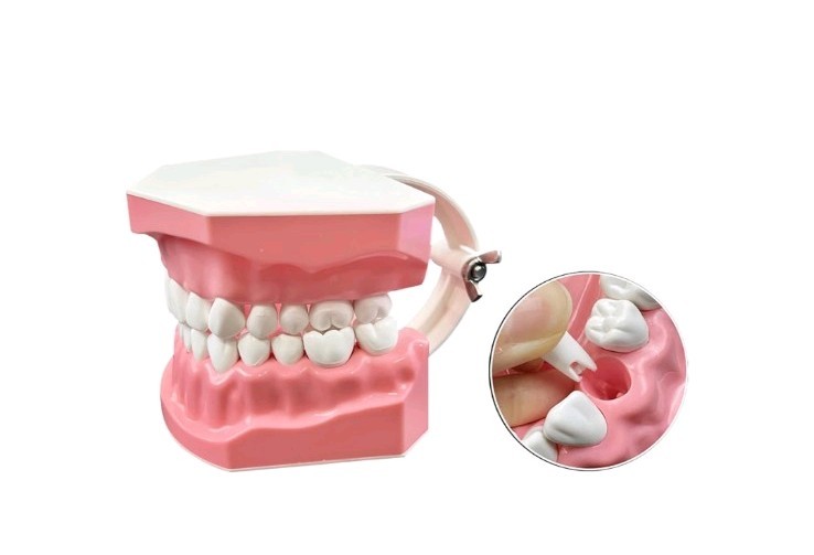 Hinged Dental Typodont Teeth Model with Toothbrush 1.5 Times Large