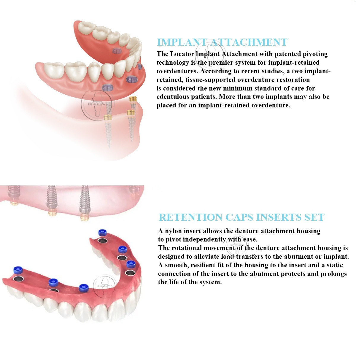 Locator abutment full set fit to Nobel Active NP platform D3.7mm GH1-6mm