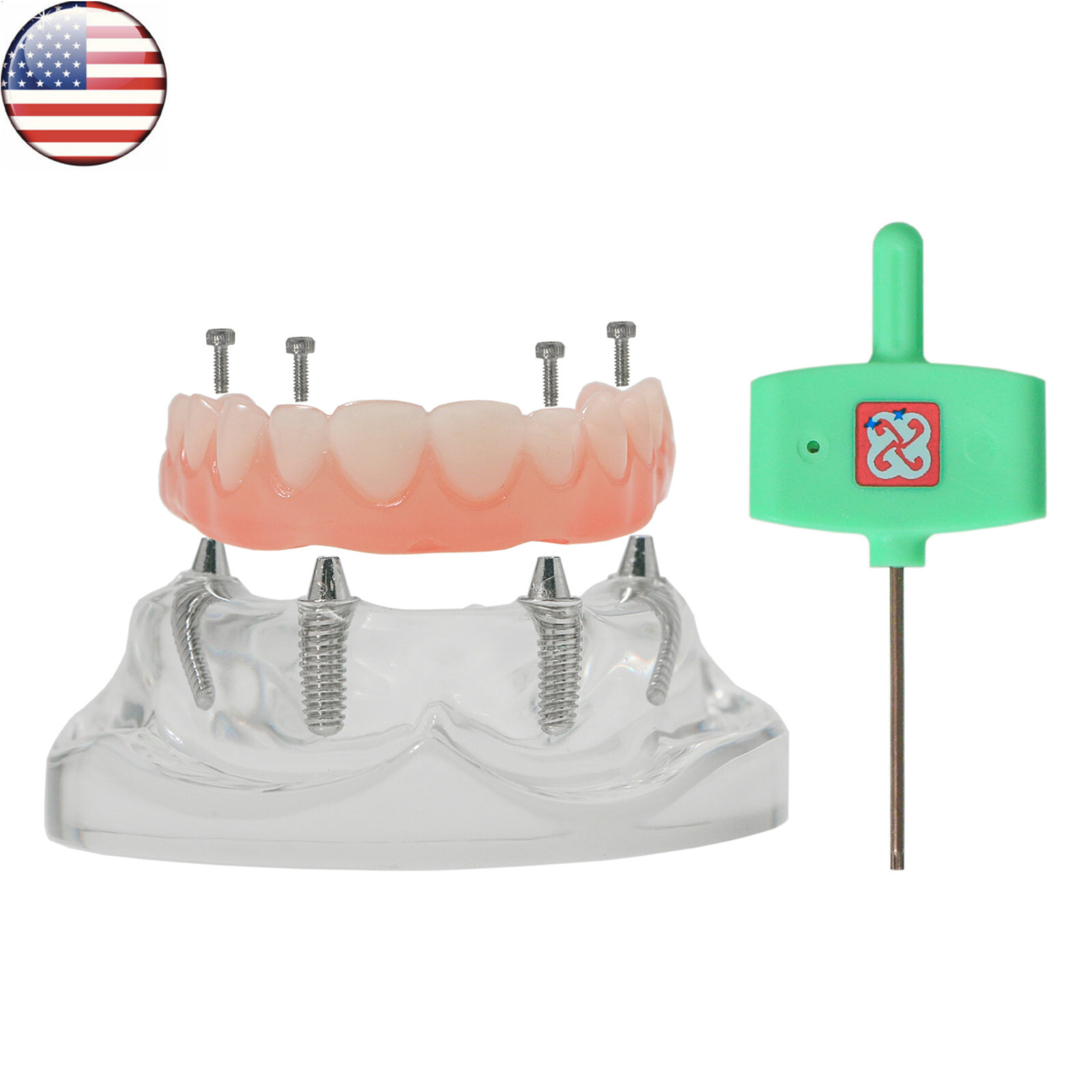 US Dental Overdenture All-on-4 Model Upper/Lower Jaw-Clear Implant With 4 Screws