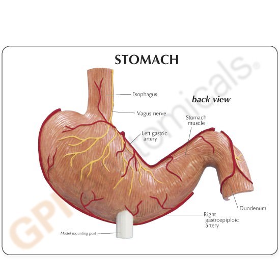 Stomach Cancer GPI Anatomical Model LFA #2001. Make Us an Offer! SEE VIDEO