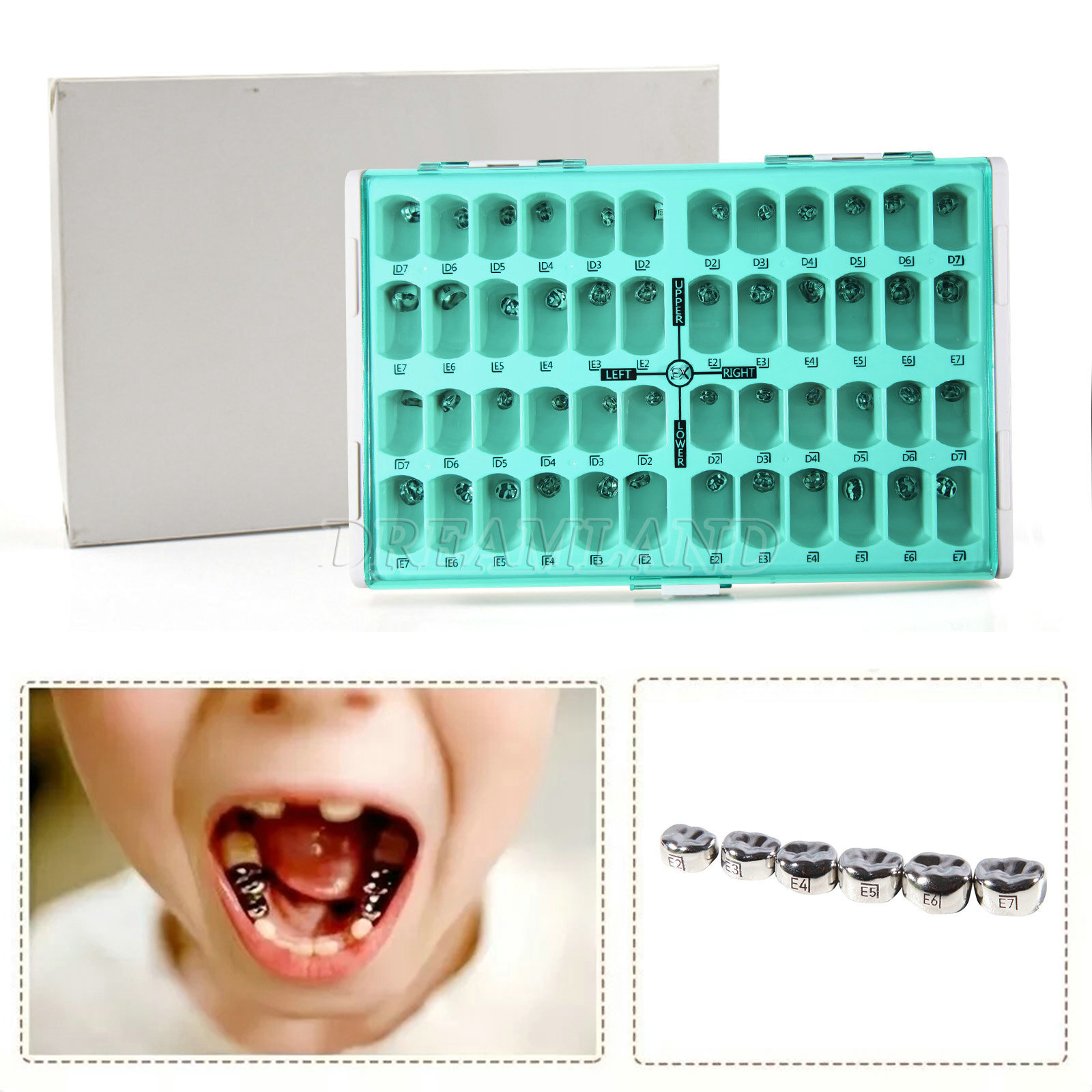 48pcs Dental Kids Adult Crown Stainless Steel Primary Molar Crowns Pediatric