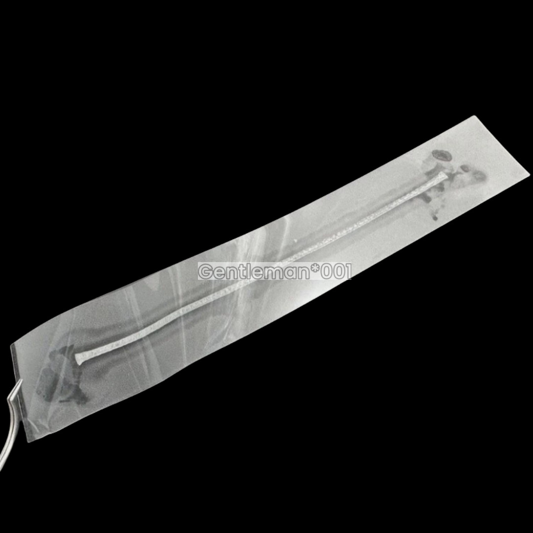 Dental Flexible Fiber Strip Band Retainer Glass Splint Loose Tooth Light Cure