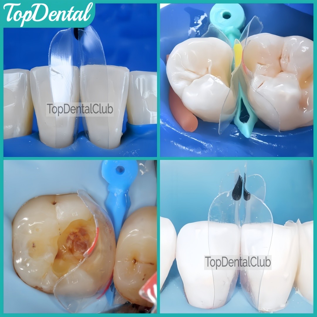 USA Clear Matrix Dental Anterior Posterior Transparent BT Matrices Fit BioClear
