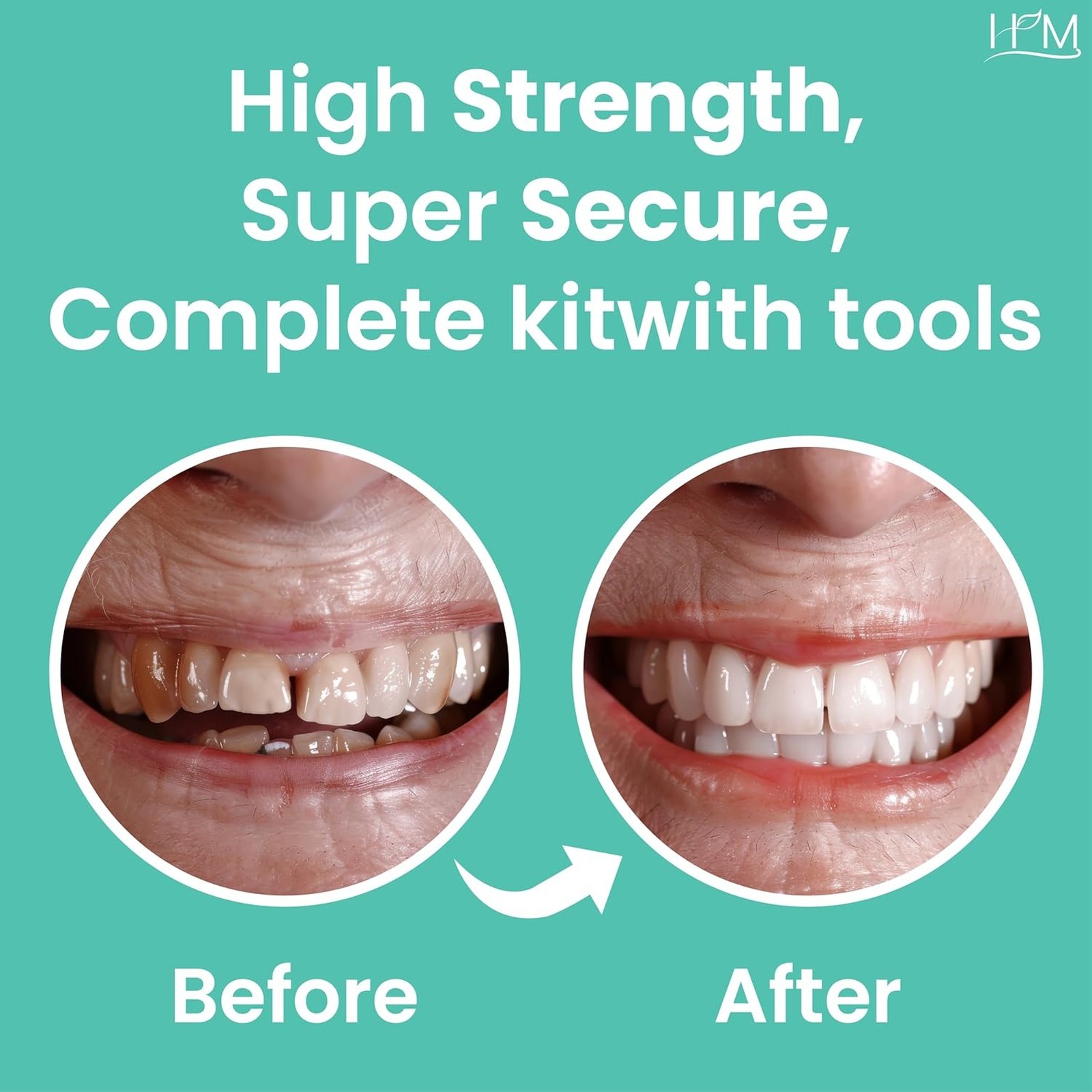 Dental Cement Kit Zinc Oxide Eugenol for Crown Filling Bridge Repair Self Curing