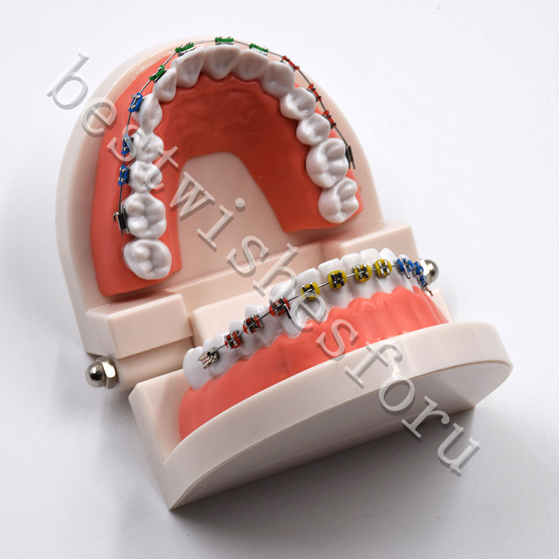 Dental Orthodontic Standard Teeth With Metal Brackets Ligature Ties Hoop Model