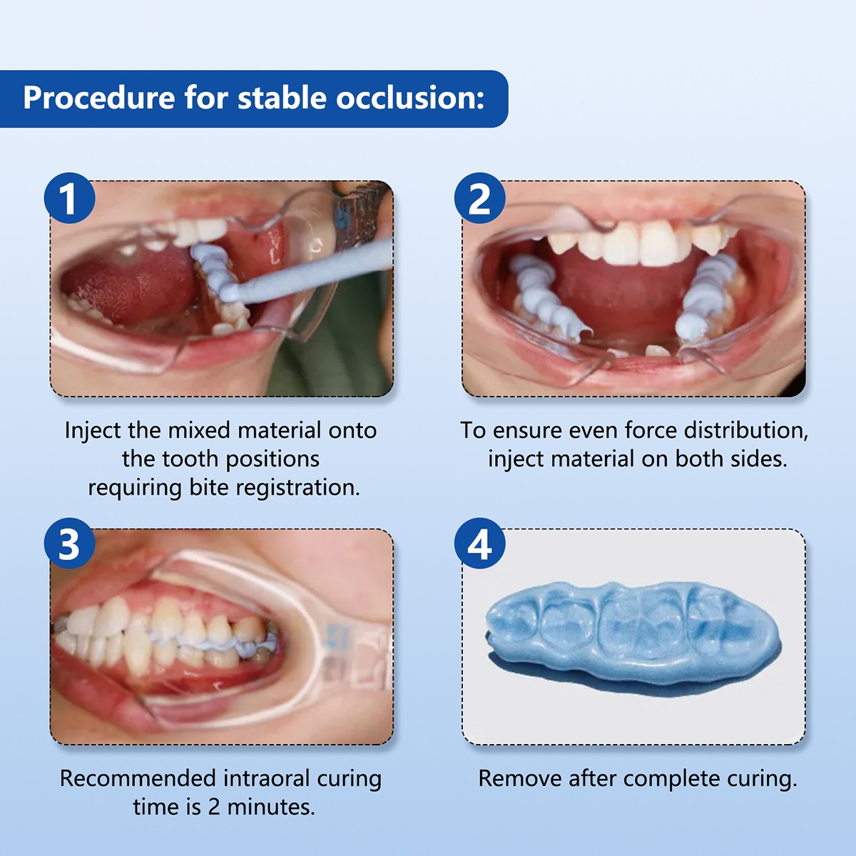 Silicone dental A para el material de registro mordedura Mezcla/Conjunto rápido