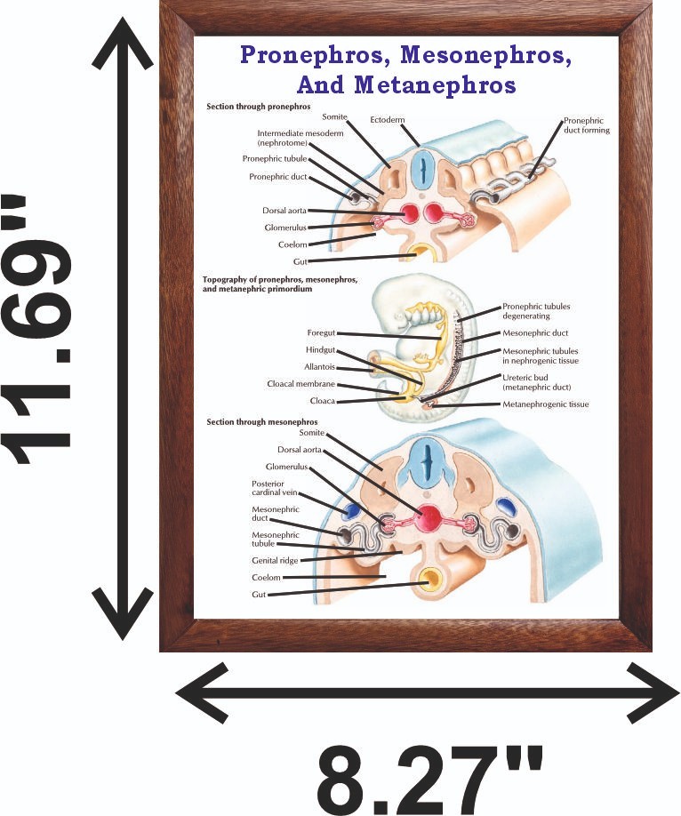 Pronephros, Mesonephros, And Metanephros Chart 12×18 inches