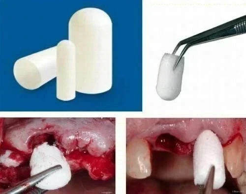 50 Pack of Colo Plug – Resorbable Collagen Plug 8x20mm. FRESH STOCK TARIFF PAID)