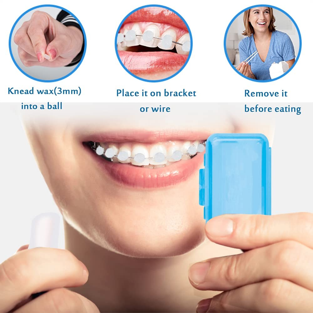 6 Pack Colorful Braces Wax – Orthodontic Dental Care Wax for Braces Wearers