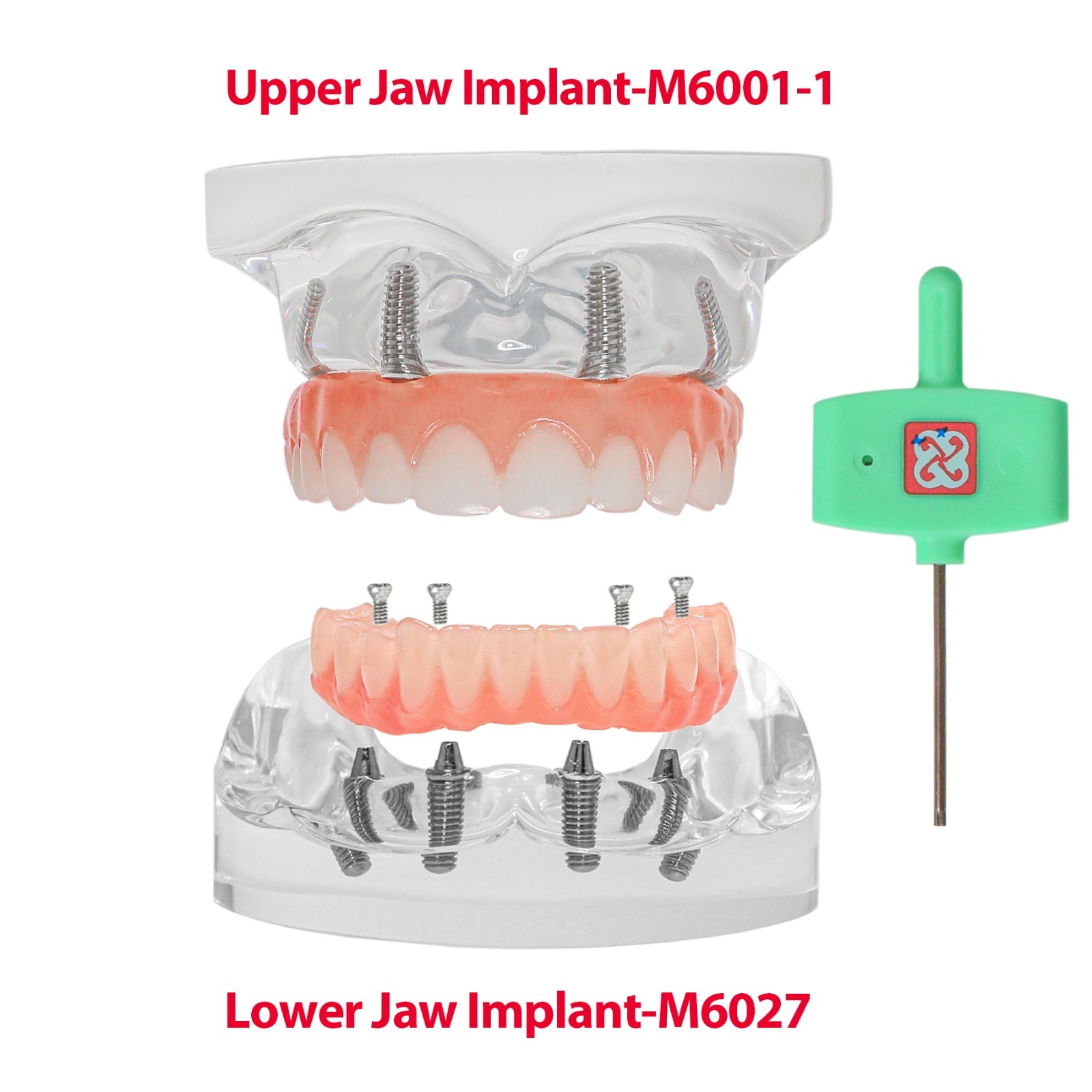 Dental Implant Overdenture Model Upper Lower Jaw Teeth Model with 2/4/6 Screws