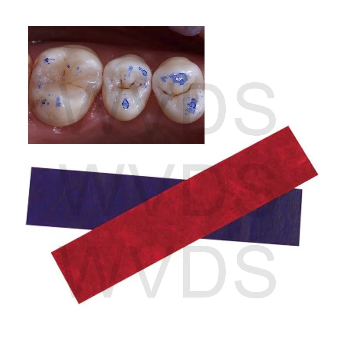 144 sheet/Box Articulating Paper Thick/Thin/X-Thin/XX-Thin