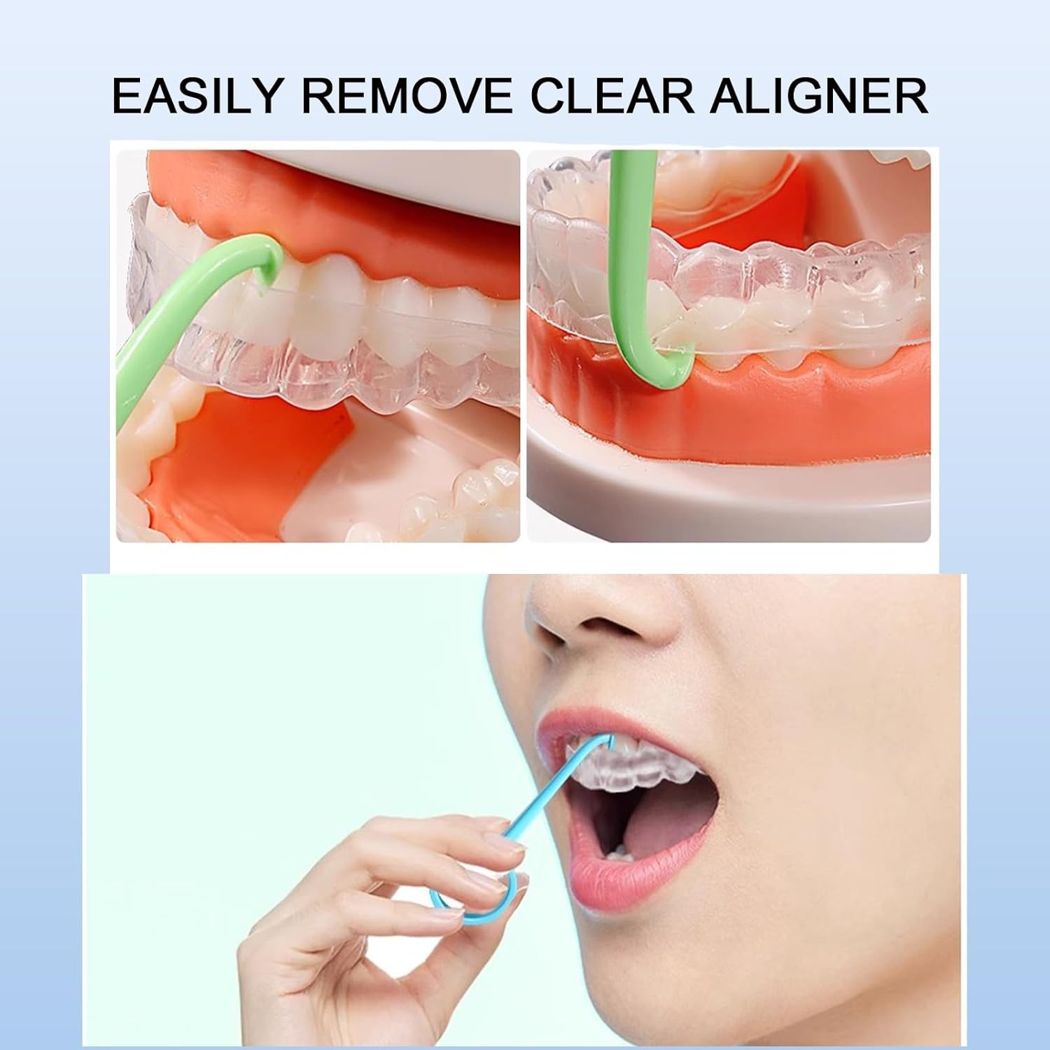 5 Pack Aligner Removal Tools – Multi-Color Retainer & Braces Remover Kit
