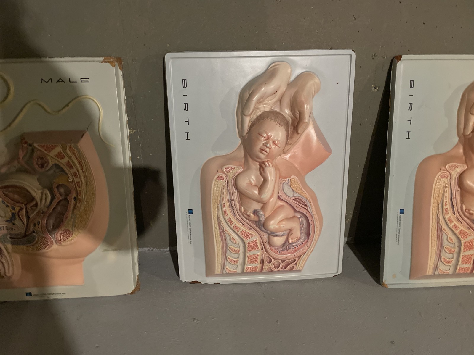 Hubbard Scientific 3D Educational Anatomy Wall Model – Birth