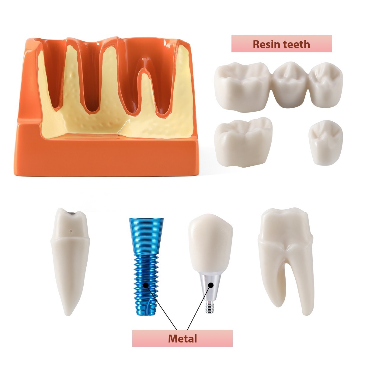 Dental 4 Times Teeth Model Implant Analysis Crown Bridge Demonstration Removable