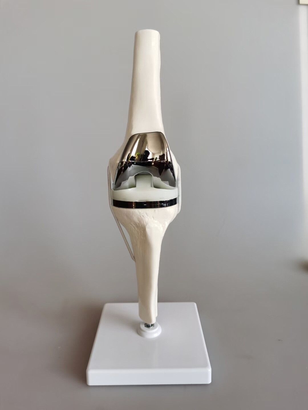Detachable Artificial Knee Prosthesis Medical Anatomical Teaching Demo Display