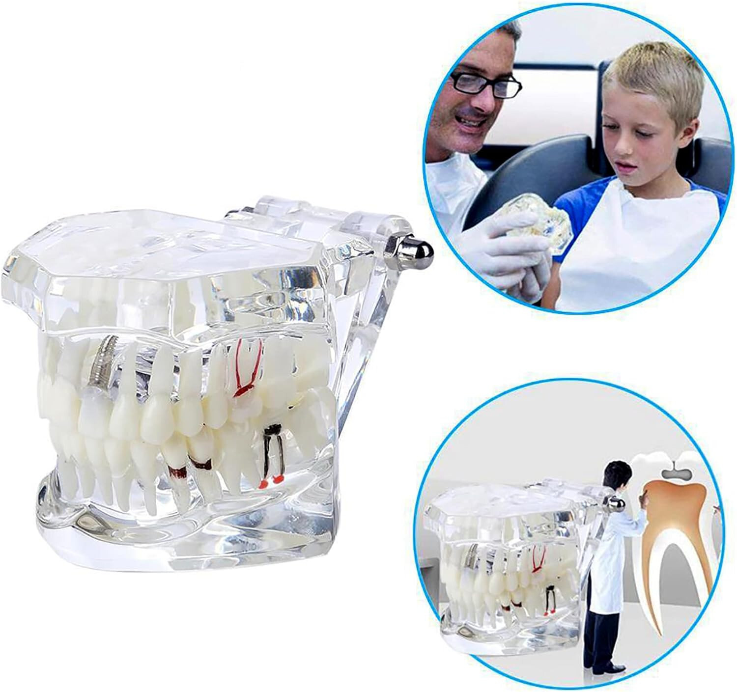 Dental Oral Typodont Model Implant Pathological Removable Teach Visible Anatomy
