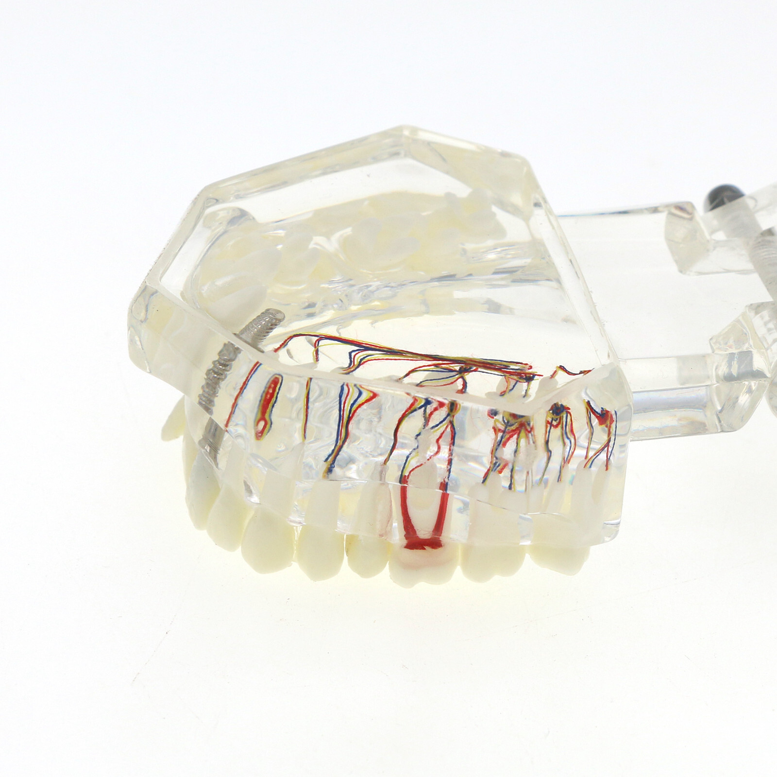 Dental Oral Typodont Model Implant Pathological Removable Teach Visible Anatomy