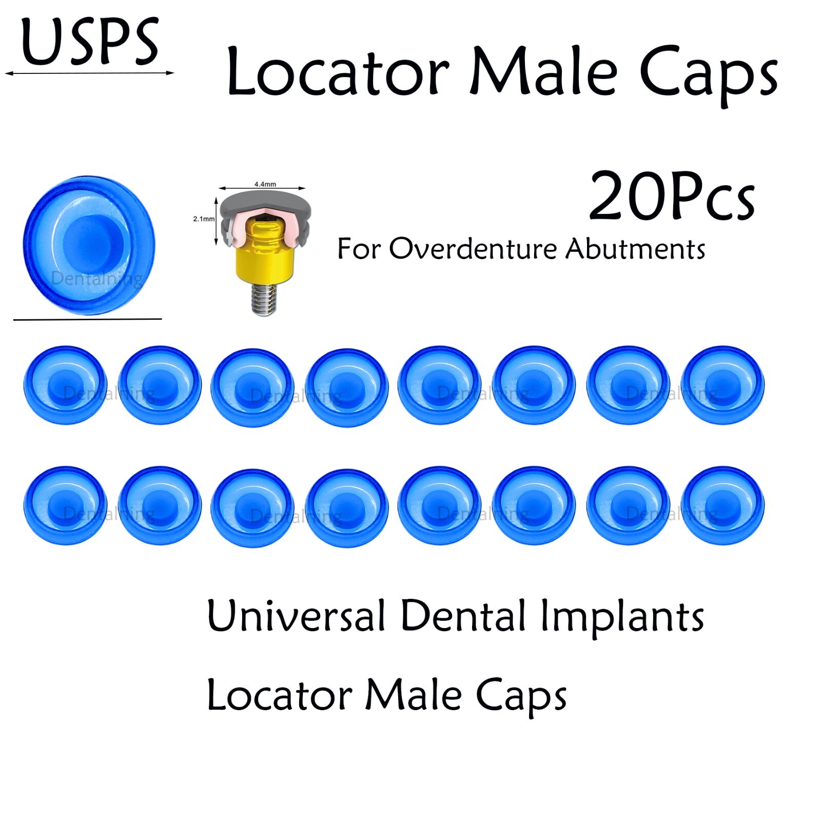 US Dental overdenture Locator Abutment Retention Caps Male Cap Inserts Set