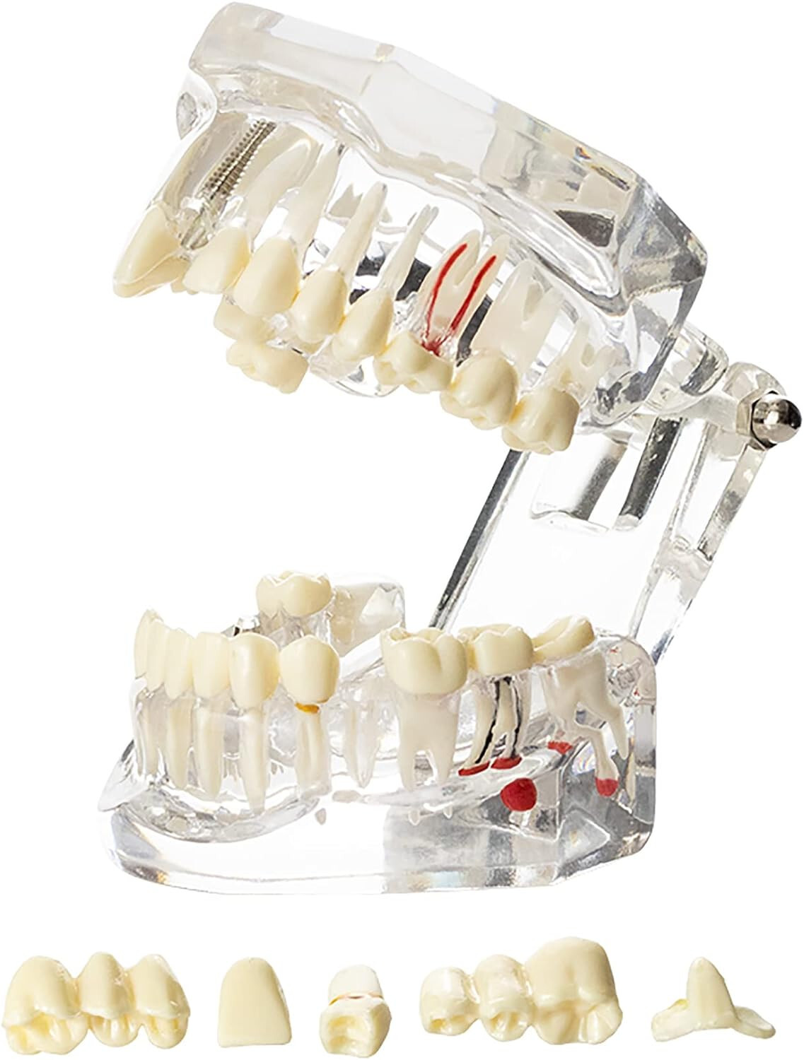 Dental Oral Typodont Model Implant Pathological Removable Teach Visible Anatomy