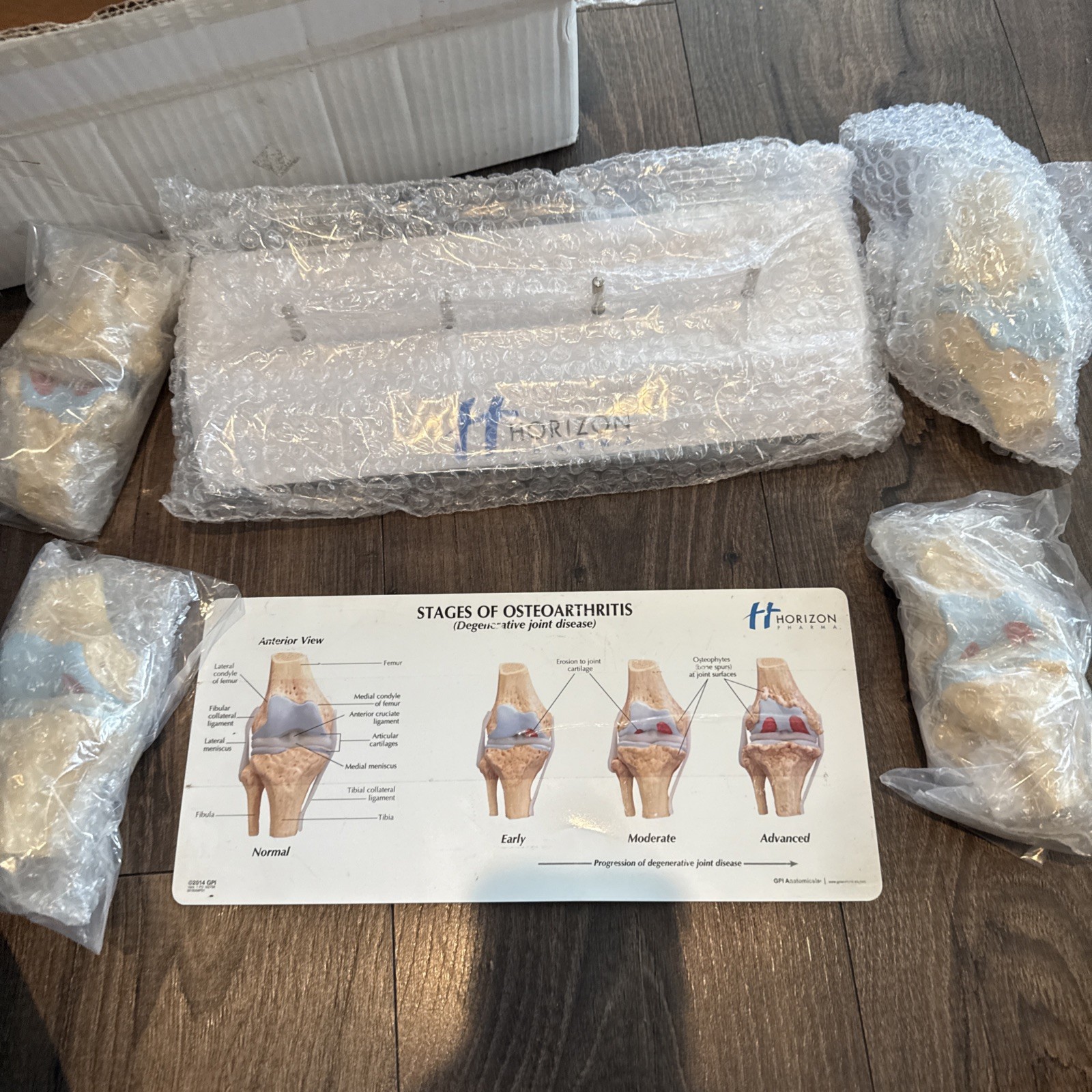 Knee Joint Osteoarthritis GPI Model Set horizon pharma