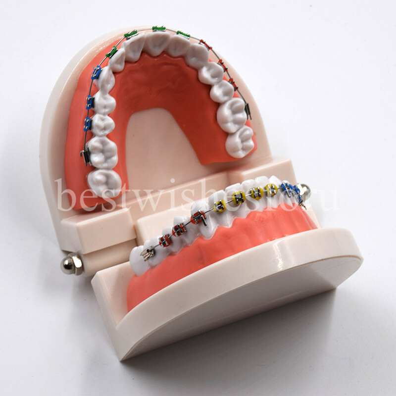 1*Dental Orthodontic Standard Teeth Tooth Model Metal Brackets & Ligature Ties
