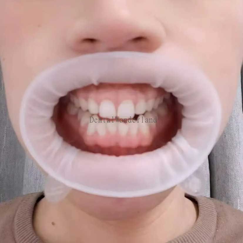 10Pcs Ivoclar Optragate Dental 3D Lip Cheek Retractor Mouth Opener Regular Adult